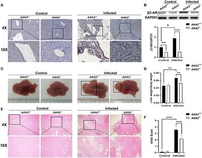 β2-Adrenergic Receptor Enhances the Alternatively Activated Macrophages and Promotes Biliary Injuries Caused by Helminth Infection